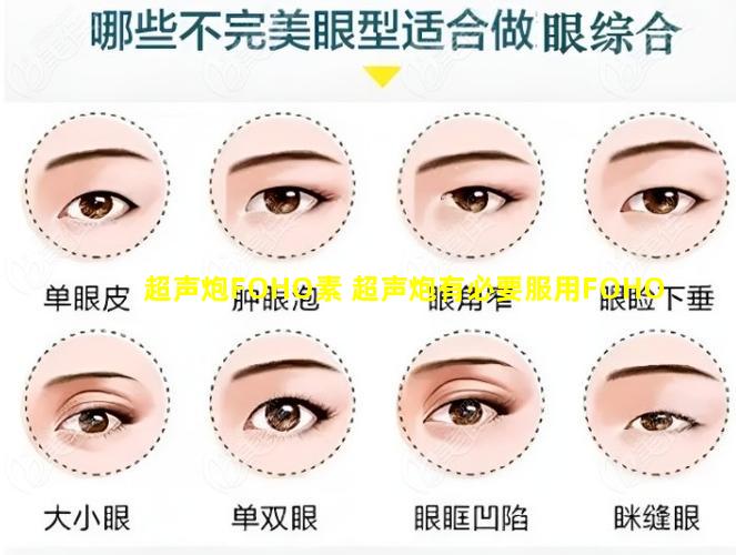 超声炮FOHO素 超声炮有必要服用FOHO